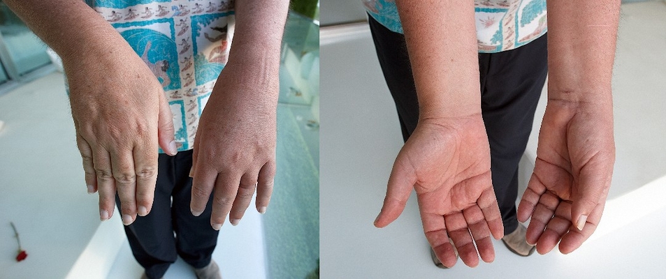 Who's got pork sausages for fingers??!!
Anahtar kelimeler: Adam Adam & Eve Hotel Antalya Belek craig Eve Holiday Hotel Resort Spa Turkey Vacation