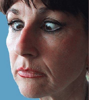 Marjorie and Crossed Eyes
Boy, will Marjorie be a happy camper when she learns that I've uploaded this photograph of her doing her party trick.
Keywords: Marjorie crosseye