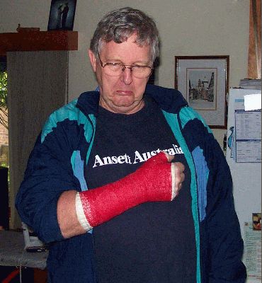 Due to come off
John on the day his plaster was due to be removed after 6 weeks, now time for physio to get the hand working properly again.
